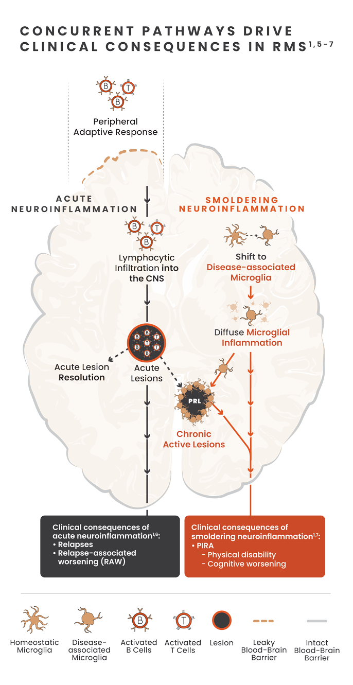 Illustration showing concurrent pathways of acute and smoldering neuroinflammation and the effects of these pathways in the brain with images of microglia, b-cells, t-cells, lesions and the blood brain barrier.