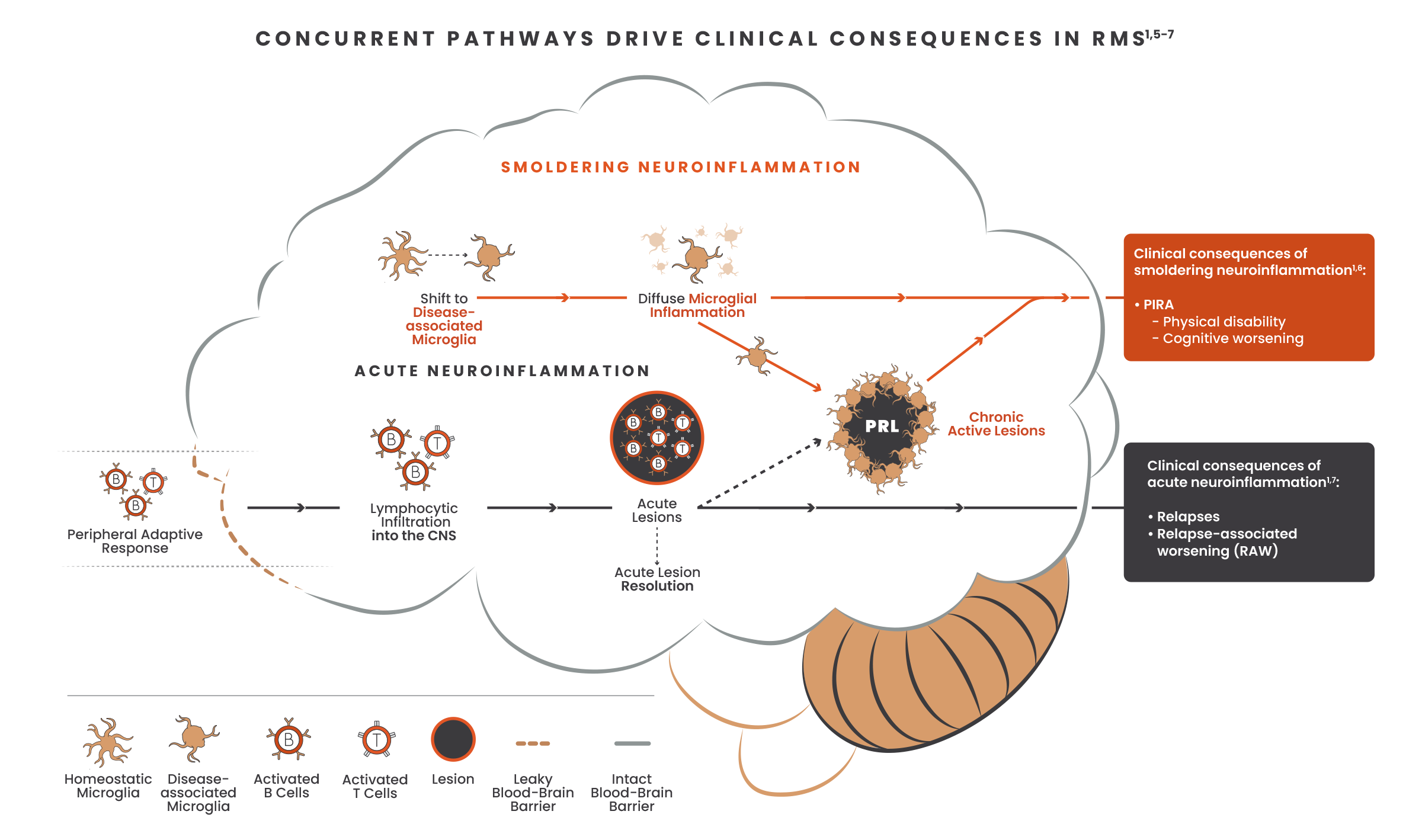 Illustration showing concurrent pathways of acute and smoldering neuroinflammation and the effects of these pathways in the brain with images of microglia, b-cells, t-cells, lesions and the blood brain barrier.