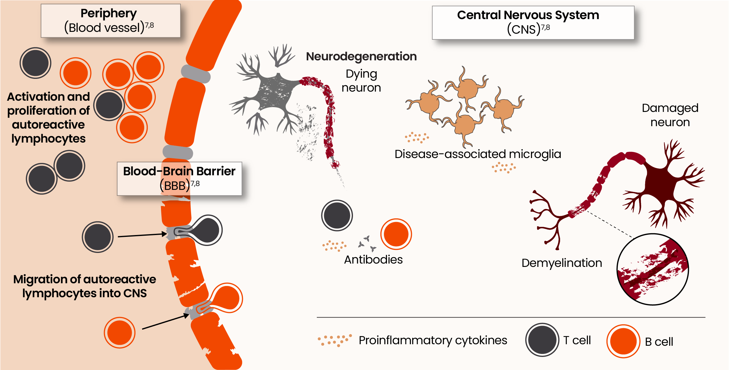 Illustration showing the pathophysiology of acute and smoldering neuroinflammation